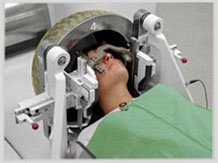 What are Gamma Knife Surgery Procedures?